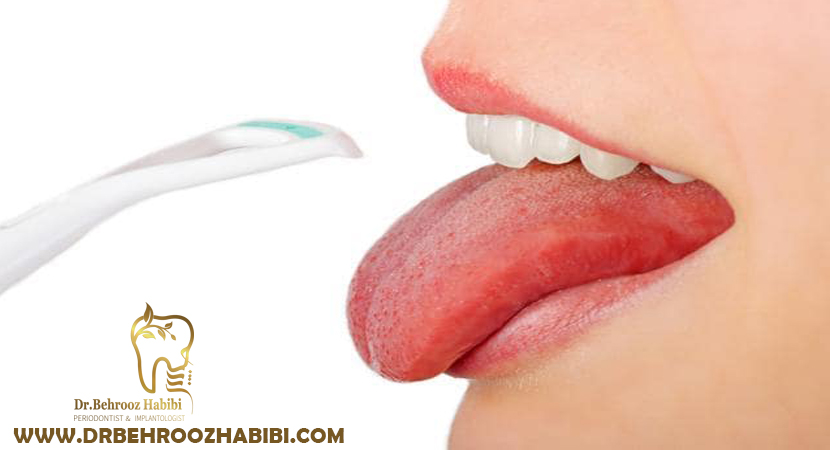 ایمپلنت دندان