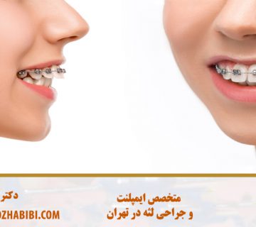 زیبایی و طراحی لبخند