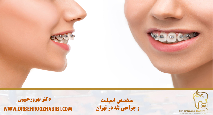 زیبایی و طراحی لبخند