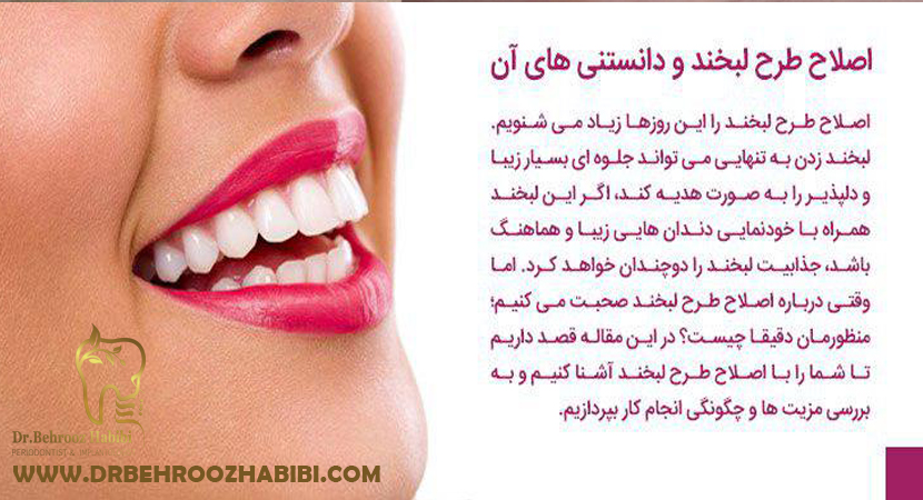 متخصص ایمپلنت در تهران