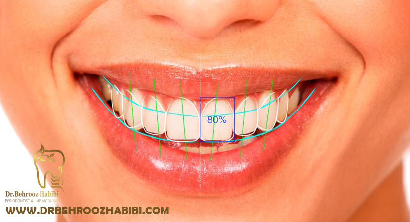 متخصص ایمپلنت در تهران