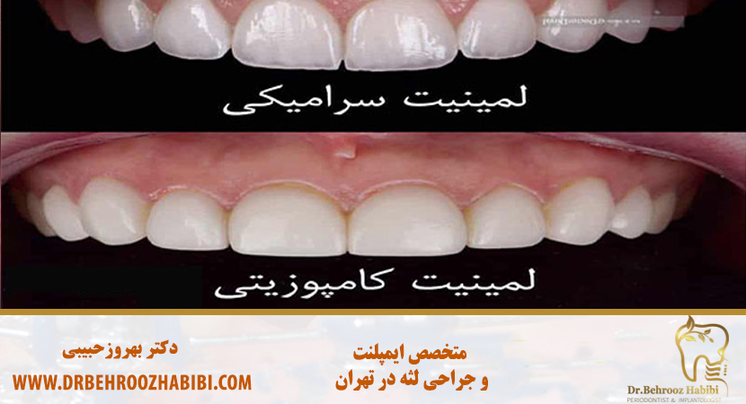 متخصص ایمپلنت