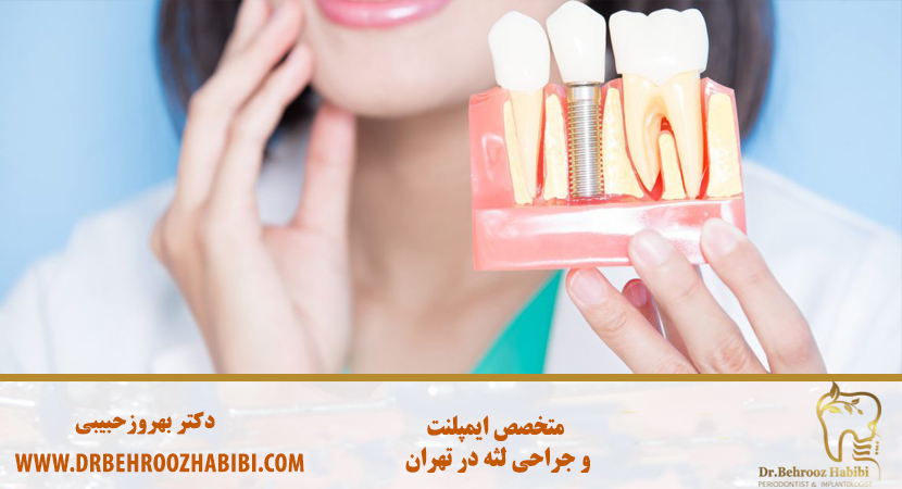 متخصص ایمپلنت