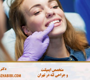 متخصص ایمپلنت