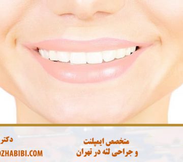 متخصص ایمپلنت