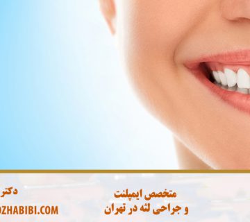 جراحی لثه با لیزر در تهران