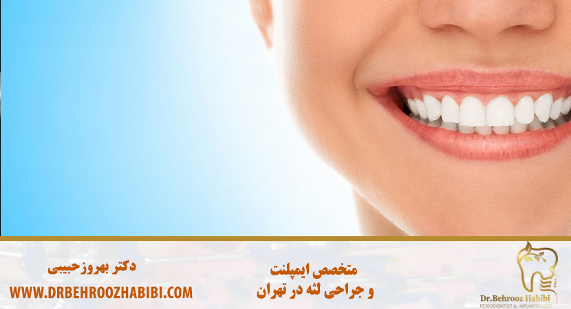 جراحی لثه با لیزر در تهران