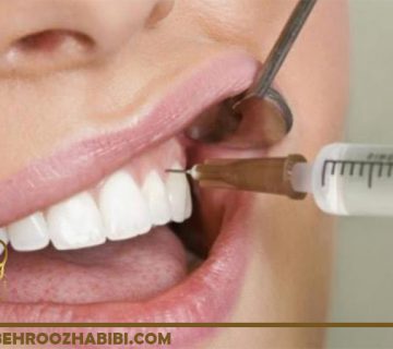 کشبدن دندان در تهران