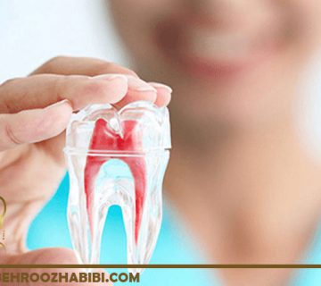 درمان ریشه در تهران