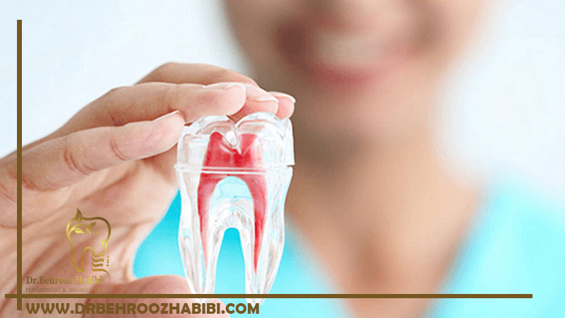 درمان ریشه در تهران