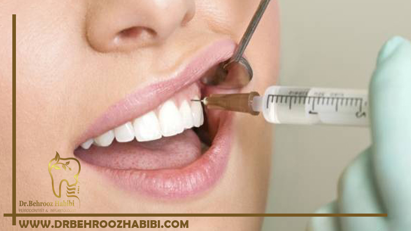 مدت زمان ماندگاری نووکائین