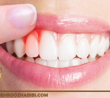 درمان بیماری لثه
