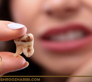 از بین بردن حفره های دندان