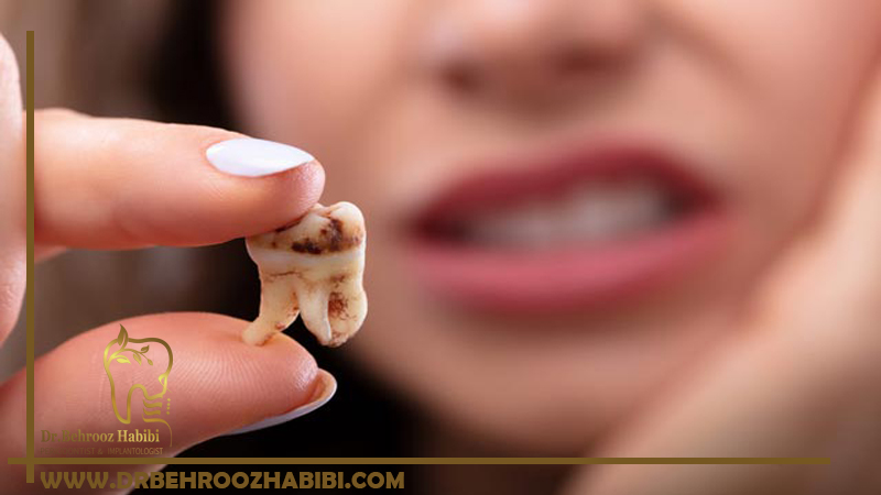 از بین بردن حفره های دندان