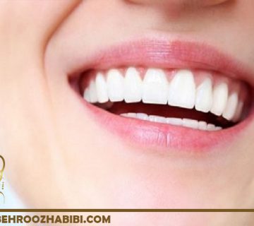 ونیر دندان در تهران