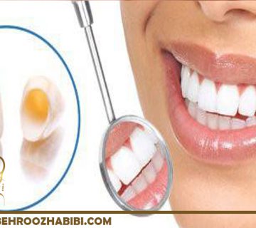 ژنژیوکتومی در تهران