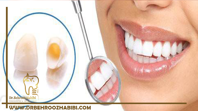 ژنژیوکتومی در تهران