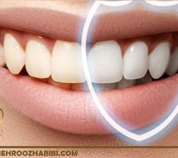 ایمنی ایمپلنت های دندان