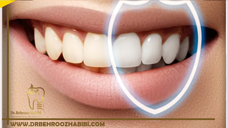 ایمنی ایمپلنت های دندان