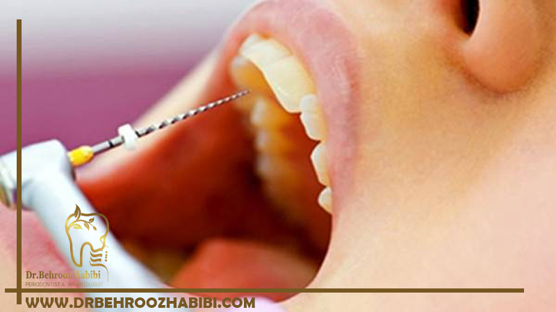 ترمیم دندان های آسیب دیده