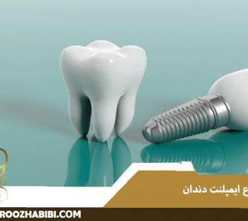 انواع ایمپلنت دندان
