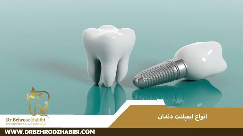 انواع ایمپلنت دندان
