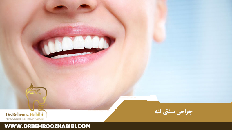 جراحی سنتی لثه