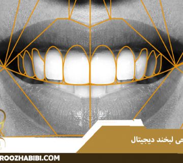 طراحی لبخند دیجیتال