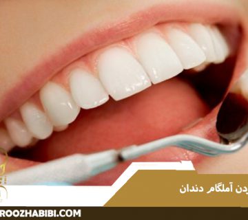 پرکردن آمالگام دندان
