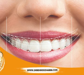 متخصص-ایمپلنت-در-تهران