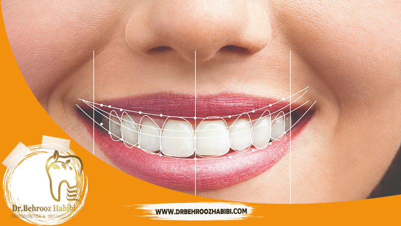 متخصص-ایمپلنت-در-تهران