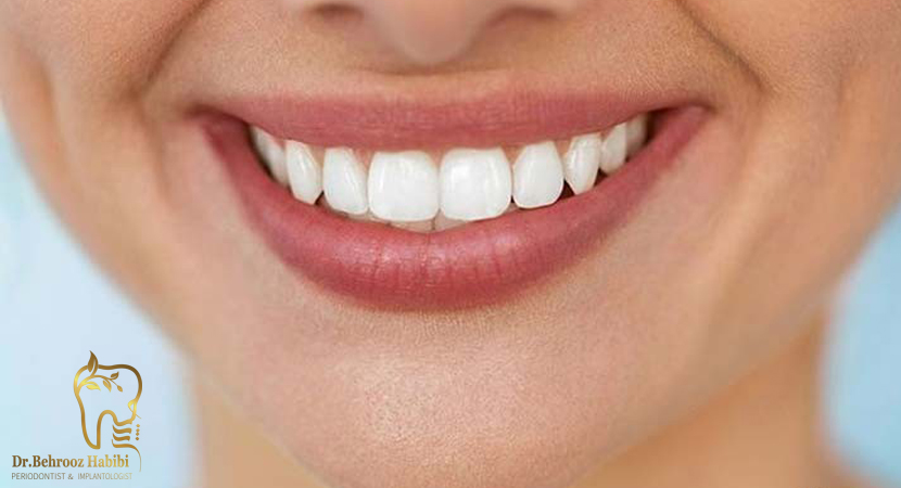 متخصص ایمپلنت در تهران