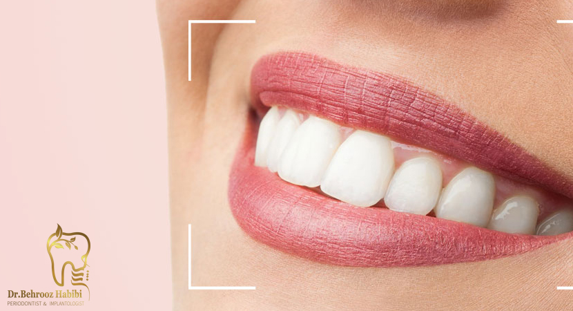 متخصص ایمپلنت در تهران