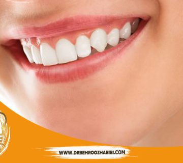 متخصص ایمپلنت در تهران