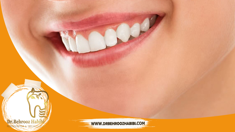 متخصص ایمپلنت در تهران