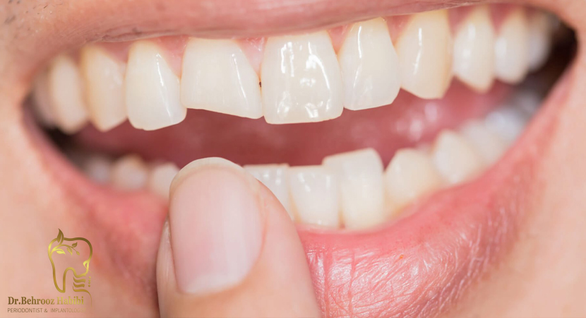 متخصص ایمپلنت در تهران