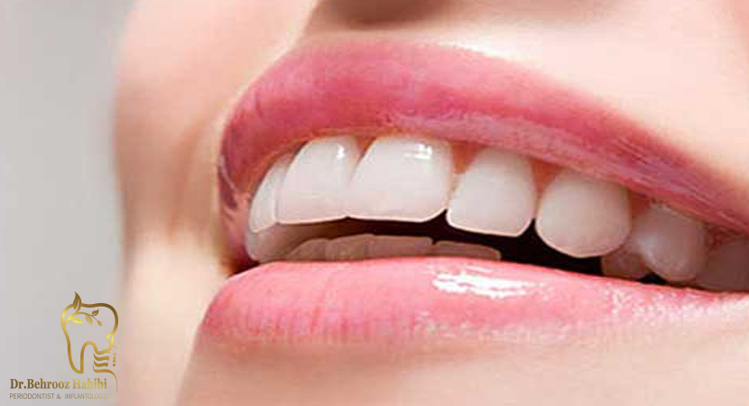 متخصص ایمپلنت در تهران