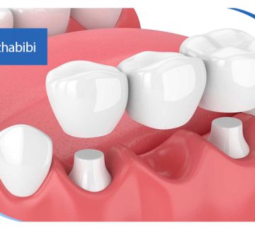 متخصص-ایمپلنت-در-تهران | دکتر-بهروز-حبیبی-در-تهران