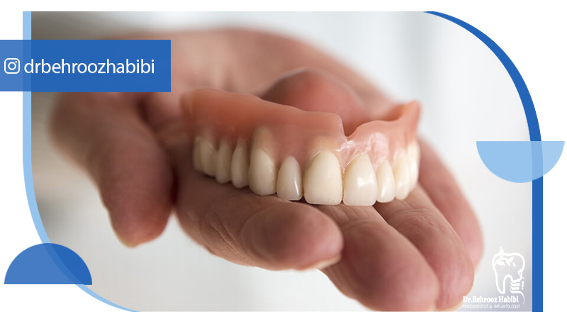 متخصص-ایمپلنت-در-تهران | دکتر-بهروز-حبیبی-در-تهران
