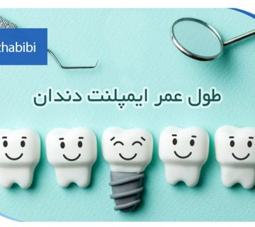 متخصص-ایمپلنت-در-تهران | دکتر-بهروز-حبیبی-در-تهران