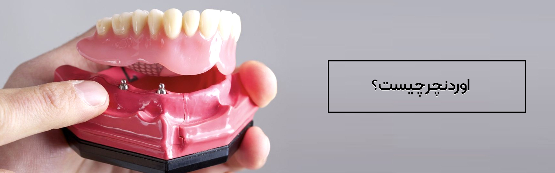 اوردنچر چیست