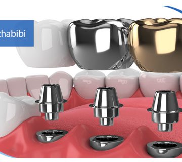 متخصص-ایمپلنت-در-تهران | دکتر-بهروز-حبیبی
