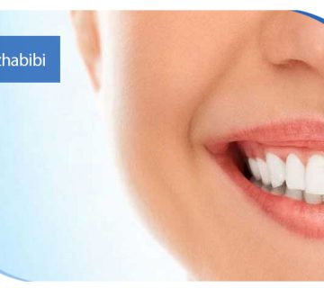 متخصص-ایمپلنت-در-تهران | دکتر-بهروز-حبیبی