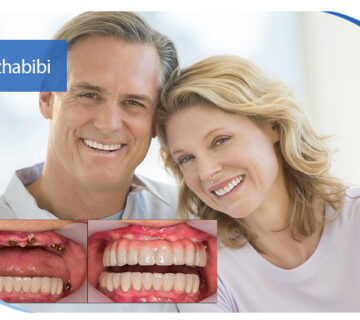 دکتر بهروز حبیبی - متخصص ایمپلنت - جراحی لثه زعفراینه - متخصص ایمپلنت در تهران