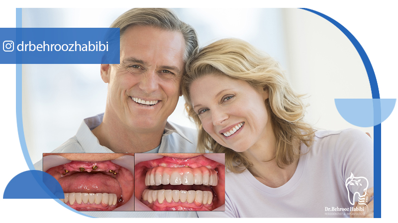دکتر بهروز حبیبی - متخصص ایمپلنت - جراحی لثه زعفراینه - متخصص ایمپلنت در تهران