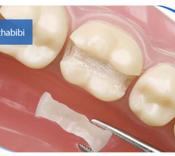 دکتر بهروز حبیبی - متخصص ایمپلنت - جراحی لثه زعفراینه - متخصص ایمپلنت در تهران