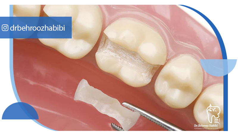 دکتر بهروز حبیبی - متخصص ایمپلنت - جراحی لثه زعفراینه - متخصص ایمپلنت در تهران