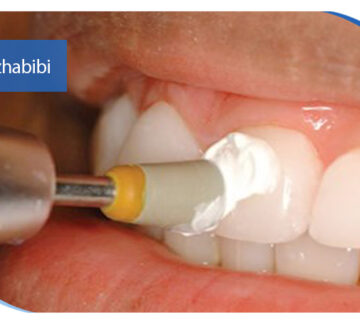 دکتر بهروز حبیبی - متخصص ایمپلنت - جراحی لثه زعفراینه - متخصص ایمپلنت در تهران