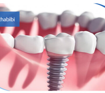 دکتر بهروز حبیبی - متخصص ایمپلنت - جراحی لثه زعفراینه - متخصص ایمپلنت در تهران