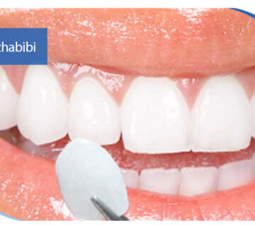 دکتر بهروز حبیبی - متخصص ایمپلنت - جراحی لثه زعفراینه - متخصص ایمپلنت در تهران